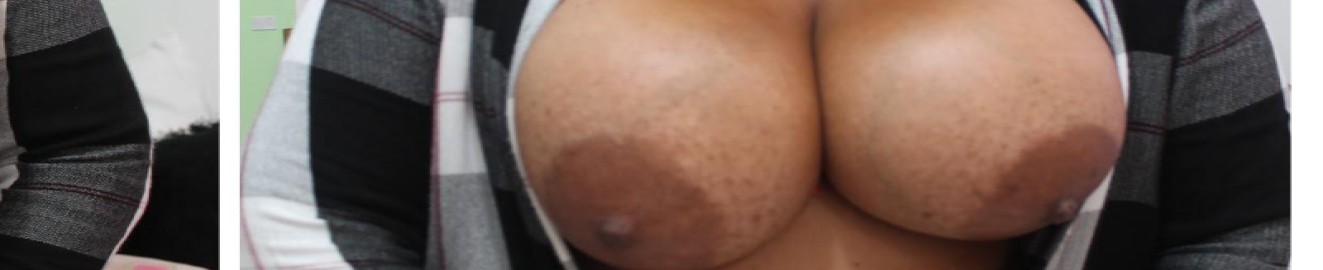 BigBantittis