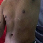 Thualexiitto35