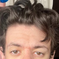 Steve SilverthornX