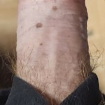 Jon E Freckles