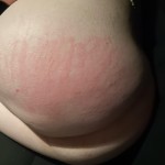 ExoticxxxKaos 