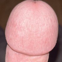 Fakecircumciced