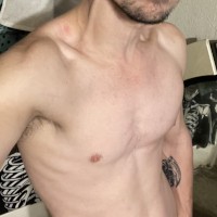 iNickolepsy