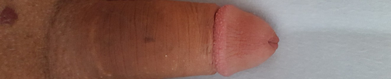 Strahlemanns Pfosten