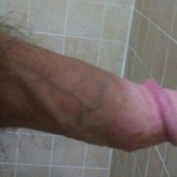 DICKisFORme