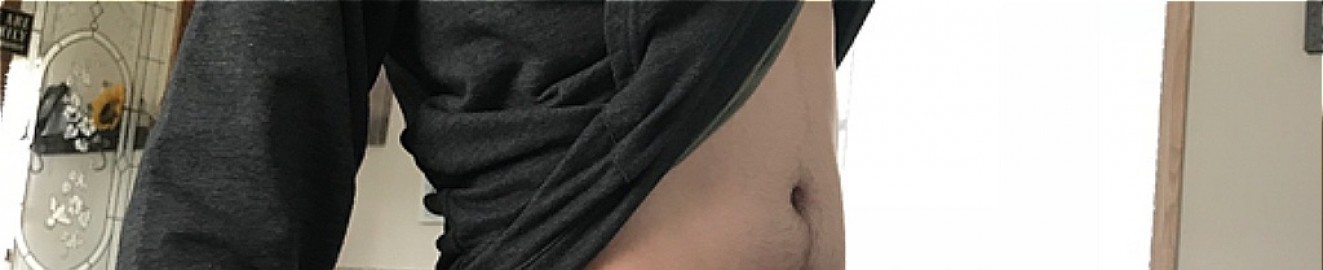 Felixandcandice