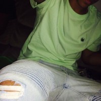 lightskinsnow