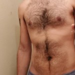 downy_dr