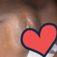 MyaaLuxe
