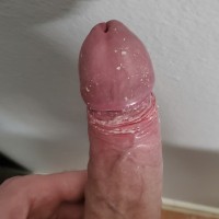 SmegmaSkin