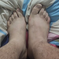 Hugefeet1