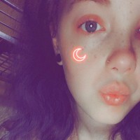 Alyxxxis