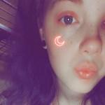 Alyxxxis
