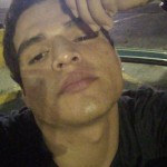 Aleeero