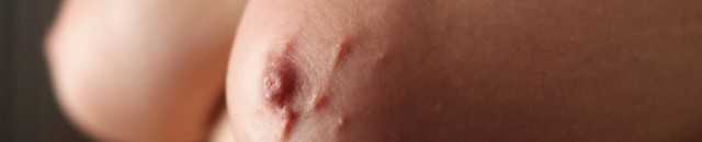 Areola Sky