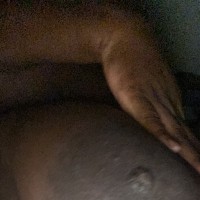 Vitiligobbw