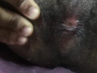 HAIRY PINK HOLE