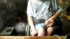 Palsy
