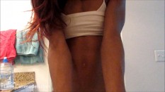 veins