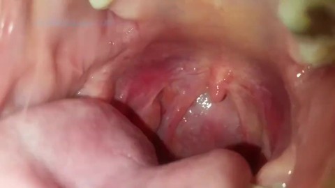 Female Endoscopic Pov Everything 6