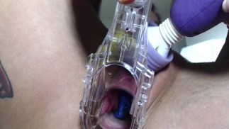 Speculum Close Up Squirt