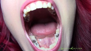 Исследование полости рта и горла при хорошем освещении