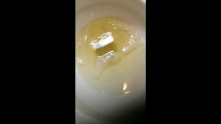 слюни и моча...