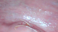Pussy 