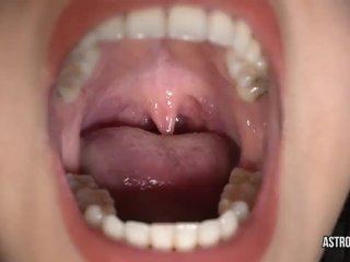 Are You Sure_You Want to Swing Down Past the Uvula of Astrodomina?