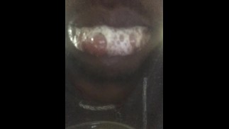 (New) My spit video 7