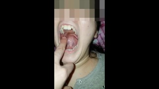 Girl Bites Fingers Very Hard
