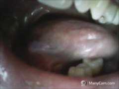 dentacci orridi