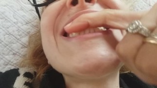 我的牙齿和牙龈！