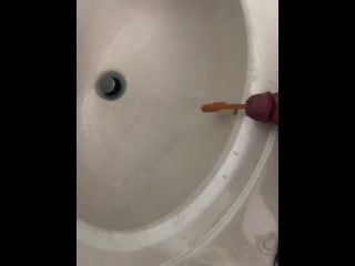 Катетеризация уретры