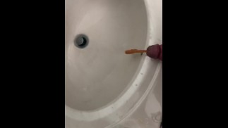 Катетеризация уретры