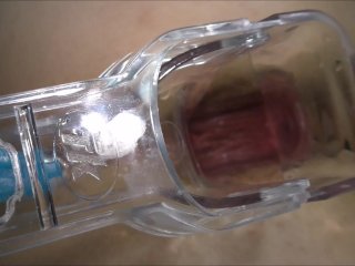 Wow Big Dildo Fully_in My Ass_Speculum in Anal Orgasm