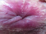 Preview 2 of ASS ASSHOLE AND ANAL COMPILATION
