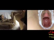 Preview 5 of Speculum insemination, make me a baby. Uterus full of sperm ! Nadine Cays