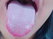 Preview 1 of Tongue, Tonsils, and Throat Examination