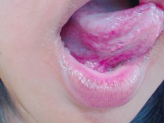 Tongue, Tonsils, and Throat Examination