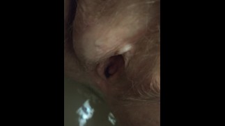 4K Pee Post Op