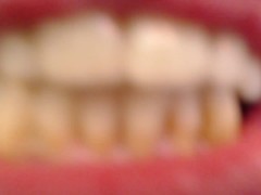 V200 Licking biting tongue, teeth lips upclose custom request with dawnSkye
