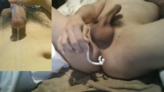 Orgasm And Cum With A Hand-Free Seminal Vesicle Prostate