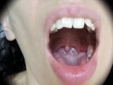 Mouth / Teeth