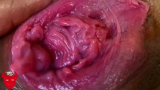 PROLAPSED Pussy Fisting & TMD Explosive FARTS