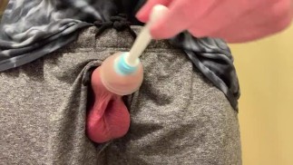 Установка аппарата для восстановления крайней плоти CAT II Q