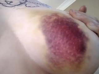 injured, solo female, big boobs, injury