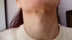 Neck fetish