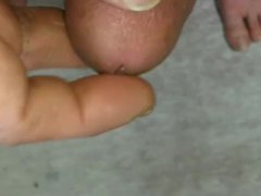 A thread appeared from an urethral opening when excited