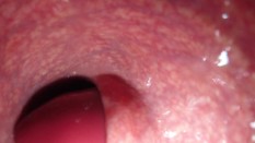 top